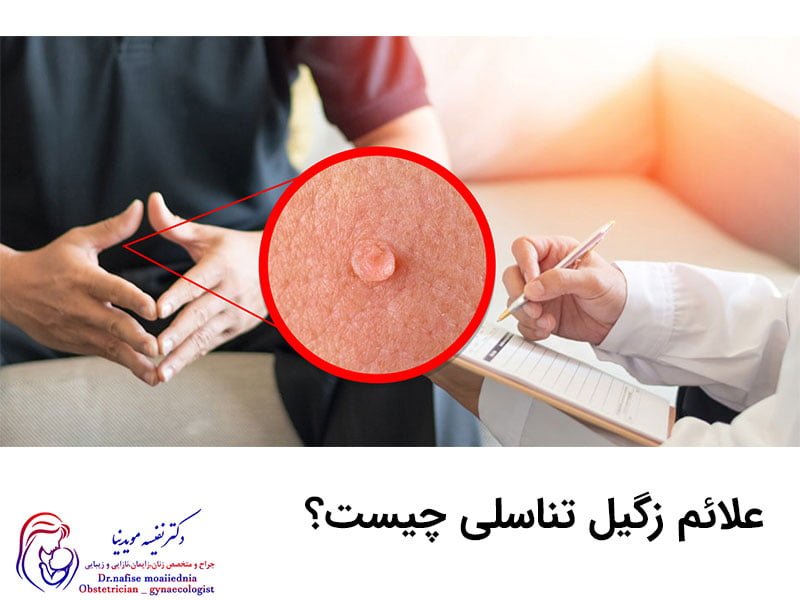 علائم زگیل تناسلی چیست؟