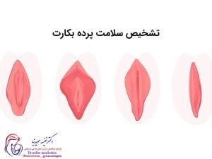تشخیص سلامت پرده بکارت
