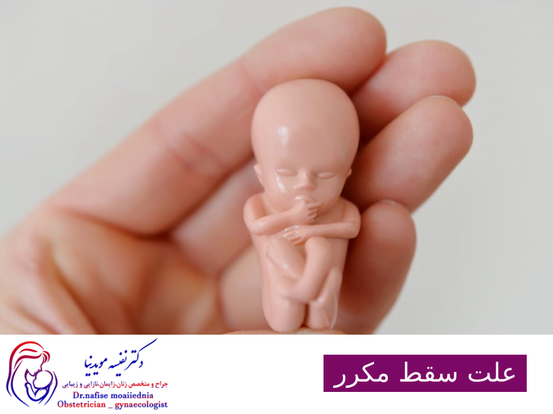 علت سقط مکرر
