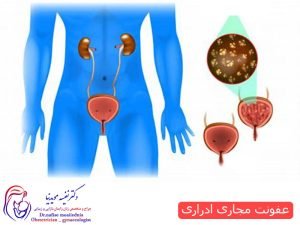 عفونت مجاری ادرار