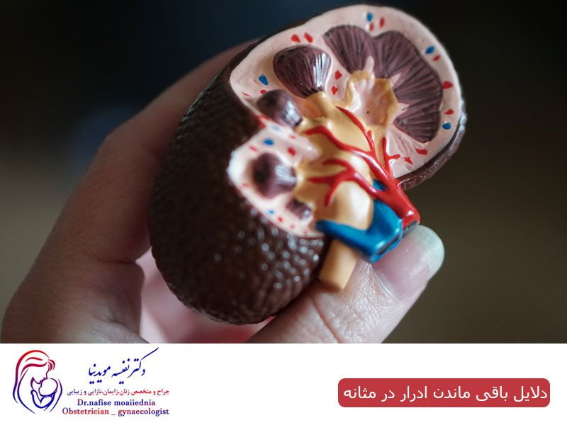 دلایل باقی ماندن ادرار در مثانه