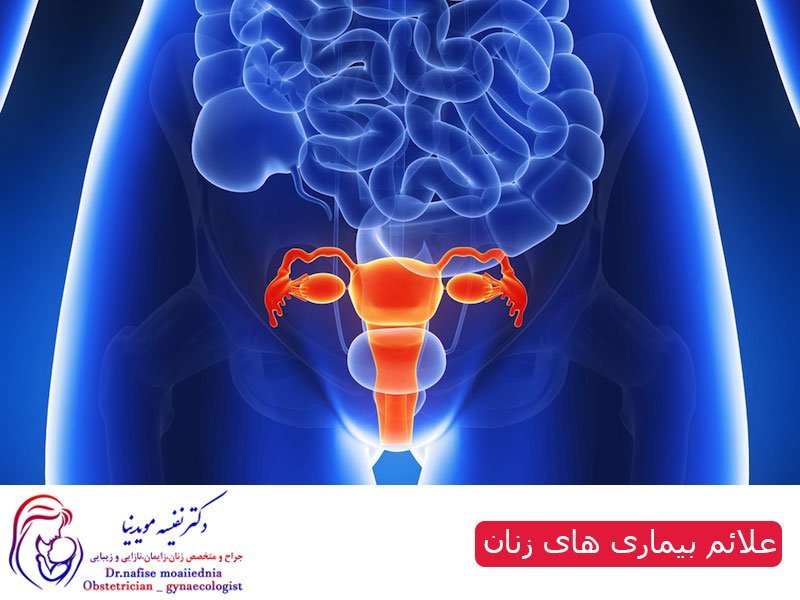 علائم بیماری های زنان