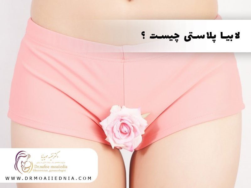 لابیا پلاستی چیست؟ | بهترین متخصص زنان رشت| دکتر نفیسه موید نیا