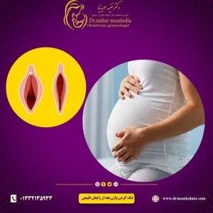 تنگ-کردن-واژن-بعد-از-زایمان-طبیعی