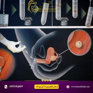 درمان-ناباروری-با-آی-وی-اف