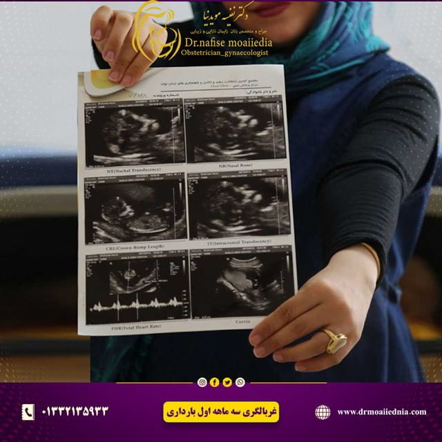 غربالگری-سه-ماهه-اول-بارداری