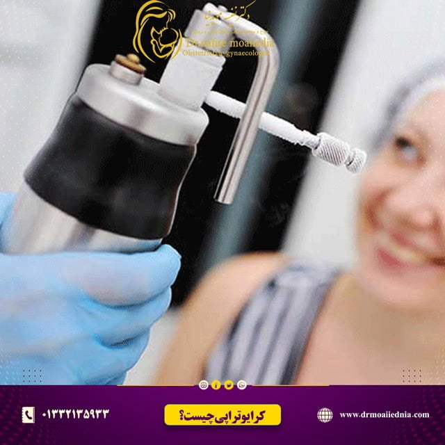 کرایوتراپی