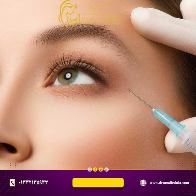 تزریق-بوتاکس-رشت