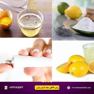 سفید-کردن-واژن-با-روش-های-خانگی