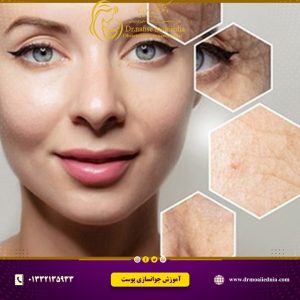 آموزش-جوانسازی-پوست