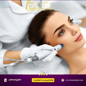 جوانسازی-پوست-با-میکرودرم