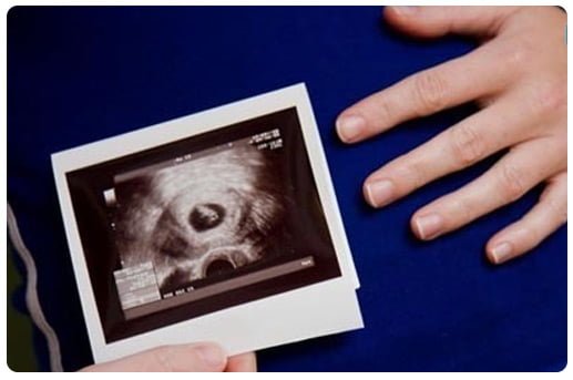 سونوگرافی-واژینال-در-بارداری